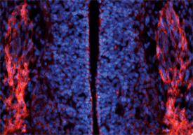ErbB3/Her3 antibody in Embryonic Mouse Dorsal Root Ganglion by Immunohistochemistry (IHC-Fr).