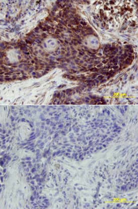 ErbB3/Her3 antibody in Human Lung by Immunohistochemistry (IHC-P).