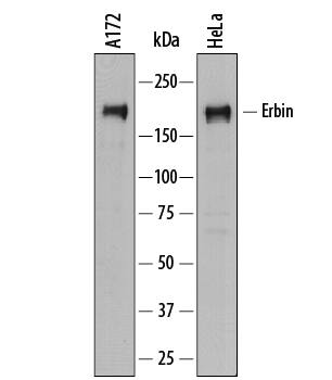 Detection of Human Erbin antibody by Western Blot.