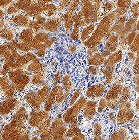 Erythropoietin/EPO antibody in Human Liver by Immunohistochemistry (IHC-P).