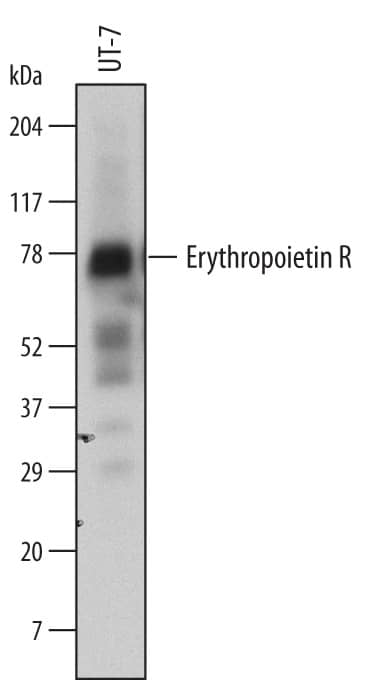 Detection of Human Erythropoietin R antibody by Western Blot.