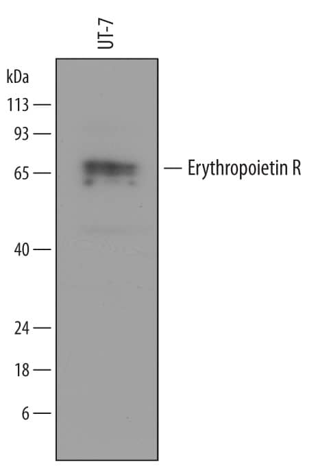 Detection of Human Erythropoietin R antibody by Western Blot.