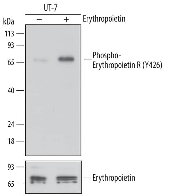 Detection of Human Phospho-Erythropoietin R (Y426) antibody by Western Blot.