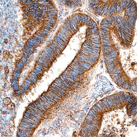 Ets-1 antibody in Human Ovary by Immunohistochemistry (IHC-P).