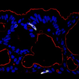 Ezrin antibody in Human Colon Stem Cells by Immunohistochemistry (IHC-P).