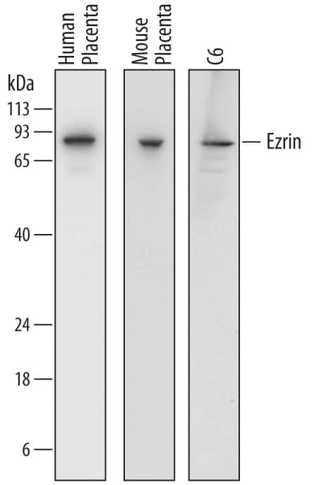 Detection of Human, Mouse, and Rat Ezrin antibody by Western Blot.