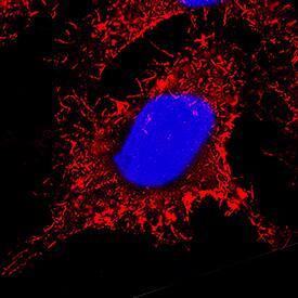 Ezrin antibody in HeLa Human Cell Line by Immunocytochemistry (ICC).