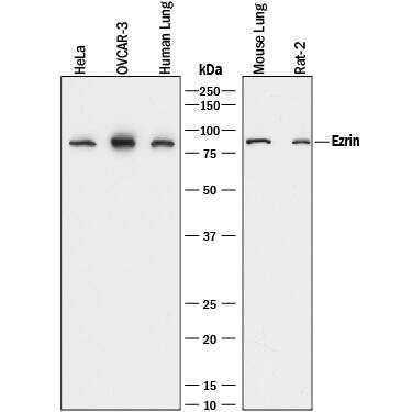 Detection of Human, Mouse, and Rat Ezrin antibody by Western Blot.