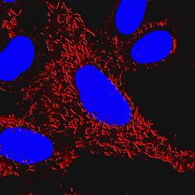 Ezrin antibody in HeLa Human Cell Line by Immunocytochemistry (ICC).