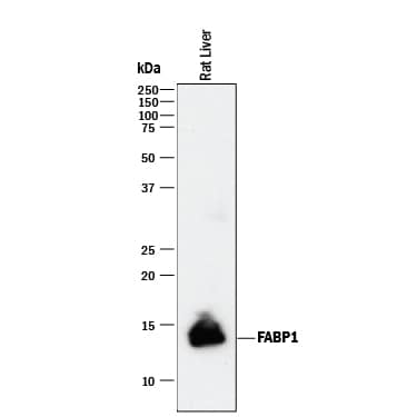 Detection of Rat FABP1/L-FABP antibody by Western Blot.