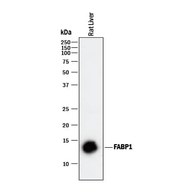 Detection of Rat FABP1/L-FABP antibody by Western Blot.