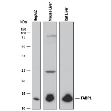 Detection of Human, Mouse, and Rat FABP1/L-FABP antibody by Western Blot.