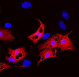 FABP2/I-FABP antibody in Rat Mesenchymal Stem Cells by Immunocytochemistry (ICC).