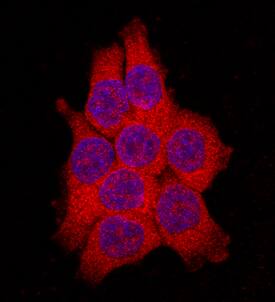 FABP2/I-FABP antibody in HCT-116 Human Cell Line by Immunocytochemistry (ICC).