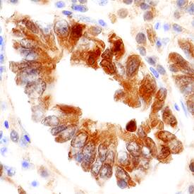 FABP2/I-FABP antibody in Human Small Intestine Tissue by Immunohistochemistry (IHC-P).