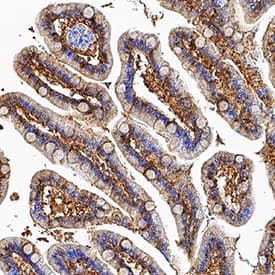 FABP2/I-FABP antibody in Human Small Intestine by Immunohistochemistry (IHC-P).