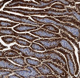 FABP2/I-FABP antibody in Human Small Intestine by Immunohistochemistry (IHC-P).