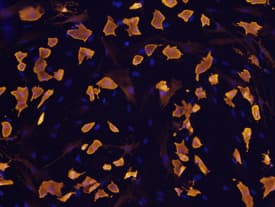 FABP4 antibody in Rat Mesenchymal Stem Cells by Immunocytochemistry (ICC).