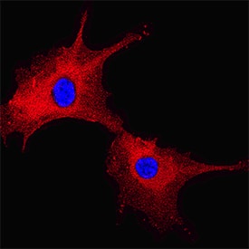 FABP5/E-FABP antibody in HUVEC Human Umbilical Vein Endothelial Cells by Immunocytochemistry (ICC).