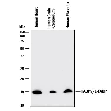 Detection of Human FABP5/E-FABP antibody by Western Blot.