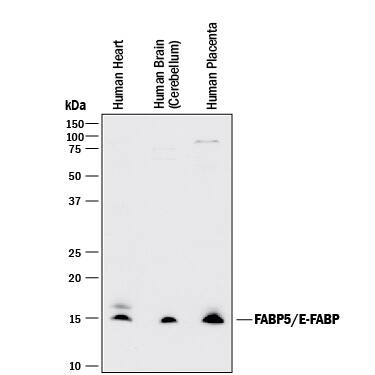 Detection of Human FABP5/E-FABP antibody by Western Blot.