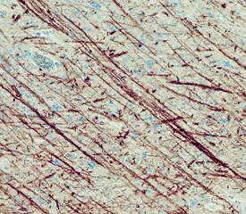 FABP8 antibody in Human Brain by Immunohistochemistry (IHC-P).