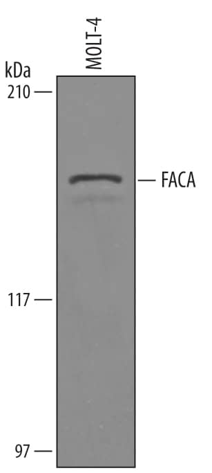 Detection of Human FACA/FANCA antibody by Western Blot.