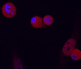 Phospho-FADD (S194) antibody in HeLa Human Cell Line by Immunocytochemistry (ICC).