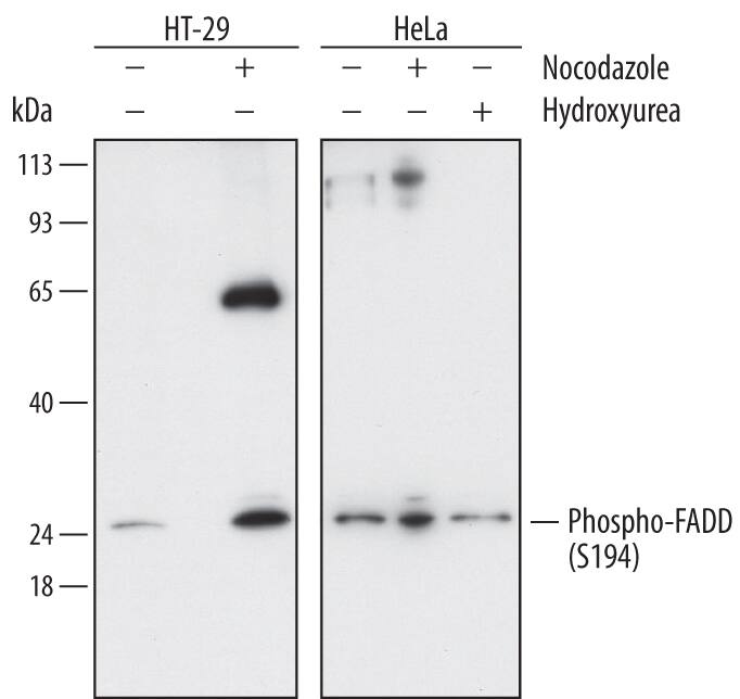 Detection of Human Phospho-FADD (S194) antibody by Western Blot.