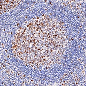 FANCD2 antibody in Human Tonsil by Immunohistochemistry (IHC-P).