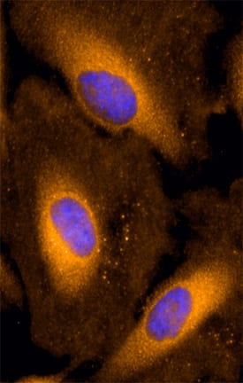 FATP1 antibody in HeLa Human Cell Line by Immunocytochemistry (ICC).