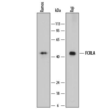 Detection of Human FCRLA antibody by Western Blot.