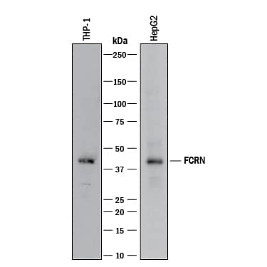 Detection of Human FCRN antibody by Western Blot.