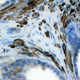 FGF-8 antibody in Human Prostate by Immunohistochemistry (IHC-P).