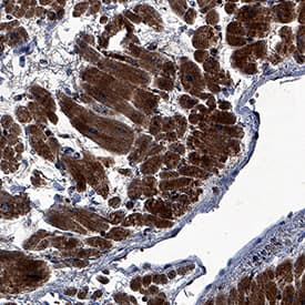 FGF-16 antibody in Human Heart by Immunohistochemistry (IHC-P).