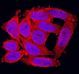 FGF-20 antibody in SW480 Human Cell Line by Immunocytochemistry (ICC).