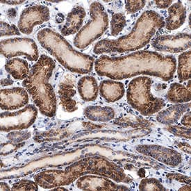 FGF R3 antibody in Human Kidney by Immunohistochemistry (IHC-P).