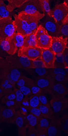 Phospho-FGF R1-4 (Y653/Y654) antibody in A431 Human Cell Line by Immunocytochemistry (ICC).