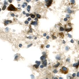 FGF R5/FGFRL1 antibody in Mouse Lung by Immunohistochemistry (IHC-Fr).