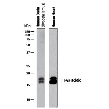 Detection of Human FGF acidic/FGF1 antibody by Western Blot.