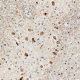 FGF acidic/FGF1 antibody in Human Brain by Immunohistochemistry (IHC-P).