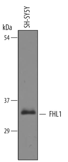 Detection of Human FHL1 antibody by Western Blot.