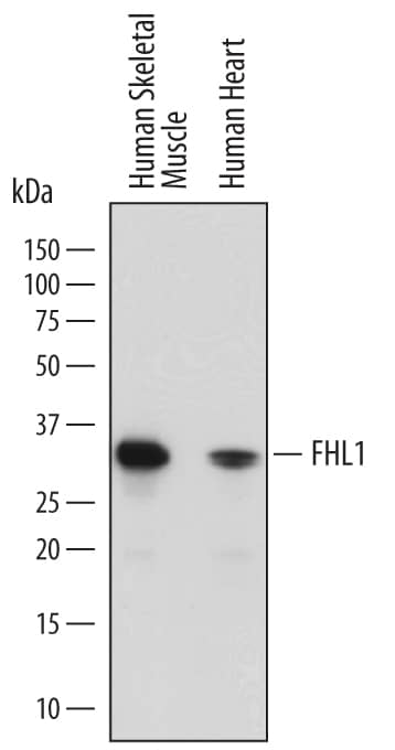 Detection of Human FHL1 antibody by Western Blot.