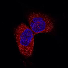 FIH-1/HIF-1AN antibody in A172 Human Cell Line by Immunocytochemistry (ICC).
