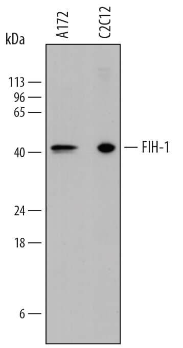 Detection of Human and Mouse FIH-1/HIF-1AN antibody by Western Blot.