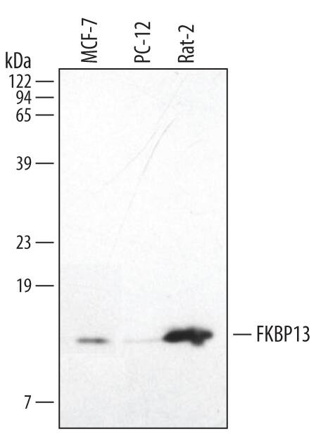 Detection of Human and Rat FKBP13 antibody by Western Blot.