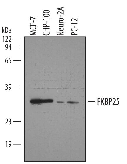 Detection of Human/Mouse/Rat FKBP25 antibody by Western Blot.