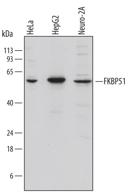 Detection of Human and Mouse FKBP51 antibody by Western Blot.