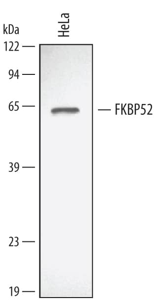 Detection of Human/Mouse/Rat FKBP52 antibody by Western Blot.