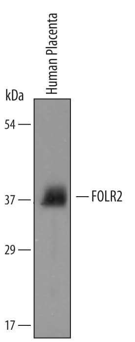 Detection of Human FOLR2 antibody by Western Blot.